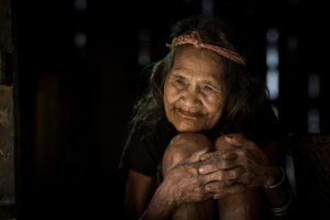 手の甲のガサガサを解消するための効果的な対策は？