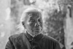 デコルテのシワにレチノールはどのような効果があるの？