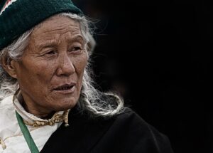 首のシワが目立つ時の効果的な対策は？